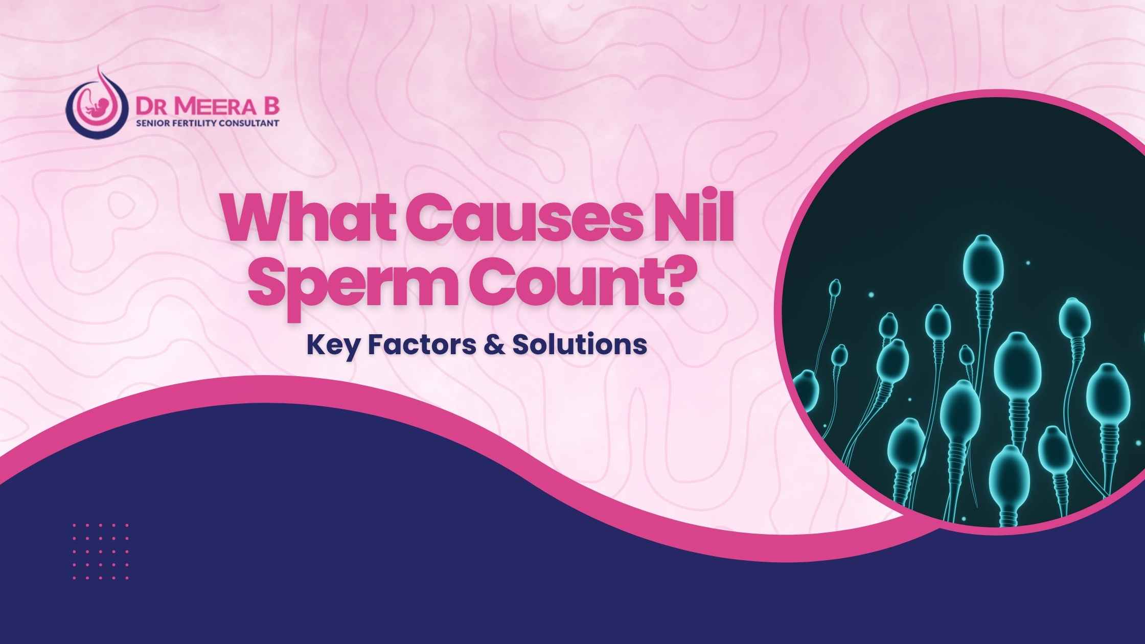 what causes NIL Sperm