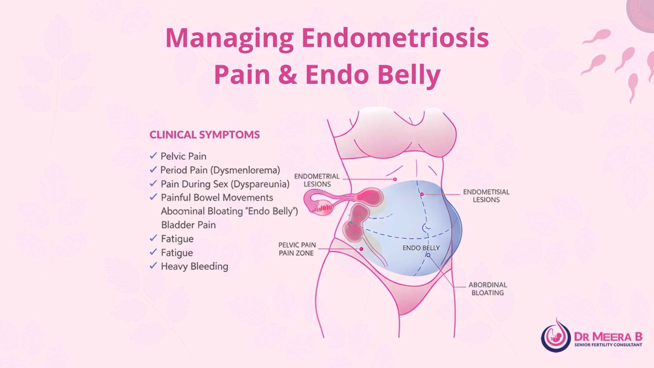 Managing Endometriosis pain