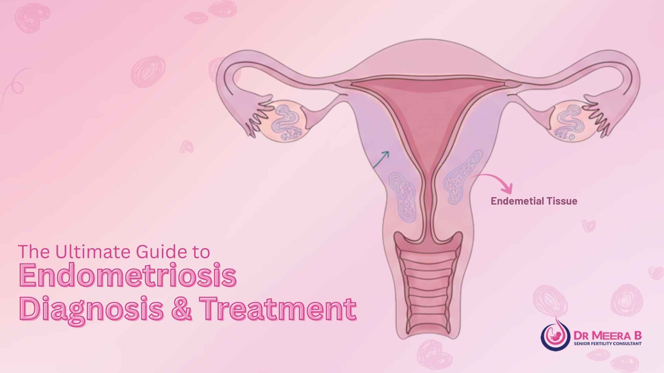 Endometriosis Diagnosis