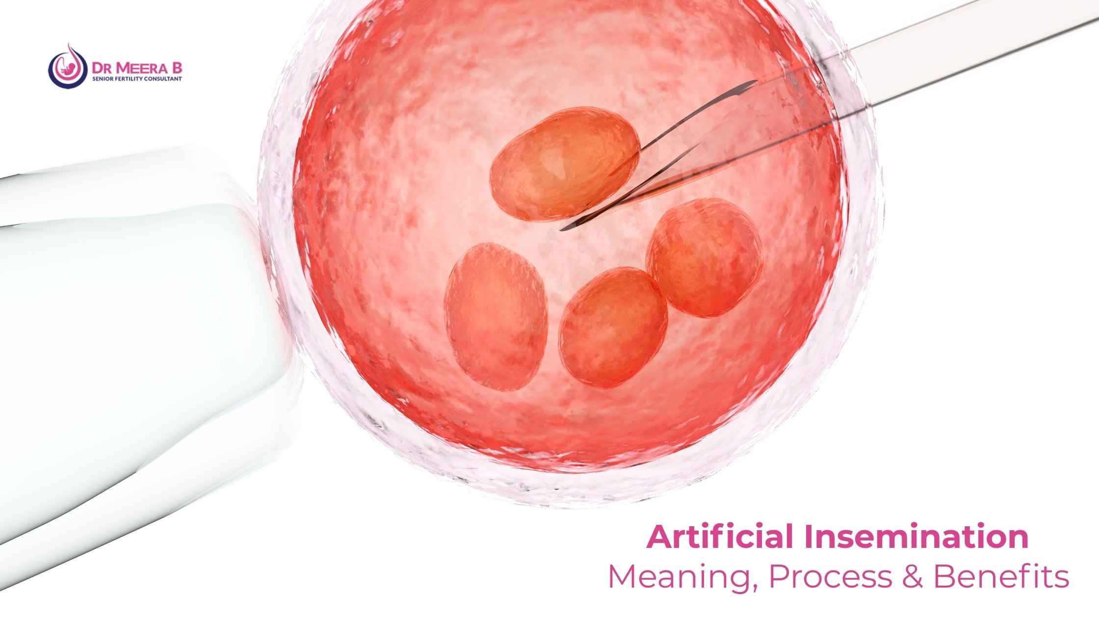 Artificial insemination