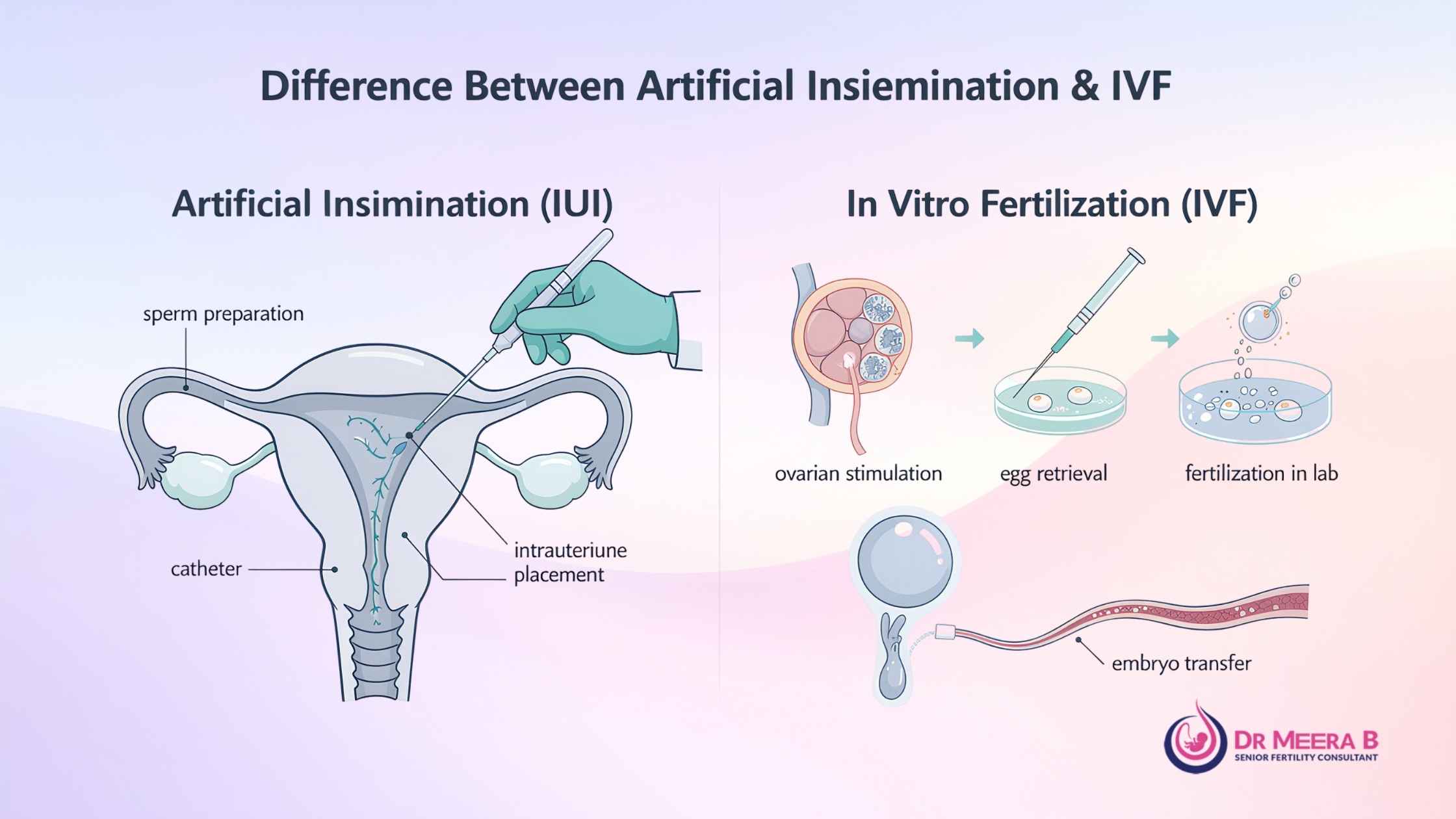 Artificial Insemination