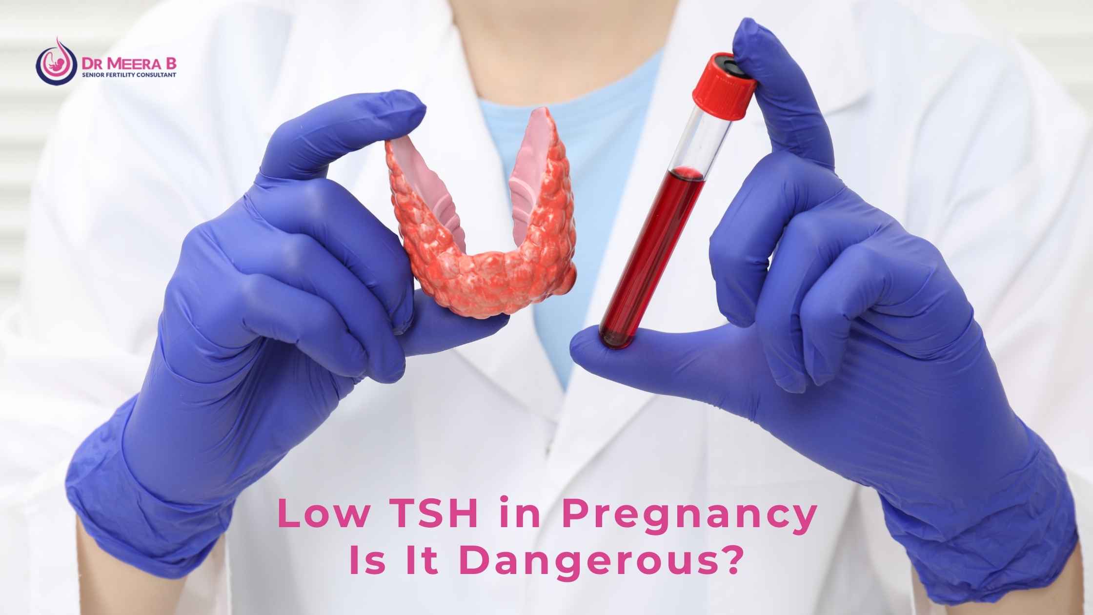 Low TSH in pregnancy
